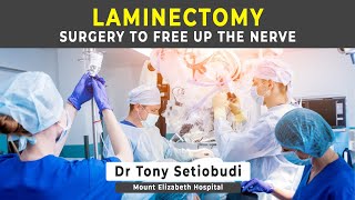 LAMINECTOMY  SURGERY FOR SPINAL STENOSIS [upl. by Ylekalb]