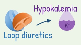 How diuretics cause hypokalemia [upl. by Luce]