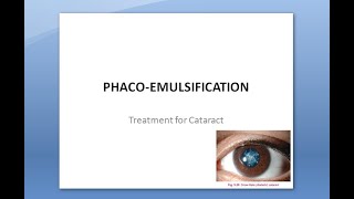 Ophthalmology 212 a PhacoEmulsification Surgery Extra Capsular Cataract Extraction [upl. by Kehoe546]