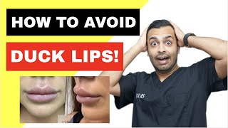 Avoiding DUCK LIPS Causes of LIP FILLER MIGRATION [upl. by Pricilla975]