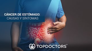 Cáncer de Estómago causas y síntomas [upl. by Saibot]