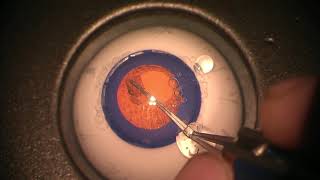 Simulated Surgery Phacoemulsification Creating Incision and Performing a Capsulorhexis [upl. by Wilmer]