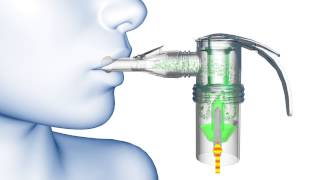 PARI LC® Nebulizer Animation [upl. by Mccullough320]