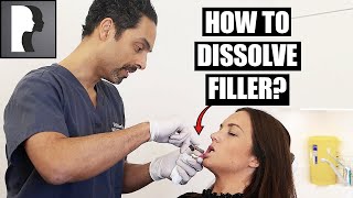 How to dissolve filler [upl. by Antin887]