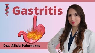 Gastritis Ardor o dolor en el estómago [upl. by Gerard460]