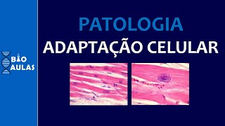 Adaptação Celular Hipertrofia Hiperplasia Hipotrofia Metaplasia Patologia Geral  Bio Aulas [upl. by Wonacott]