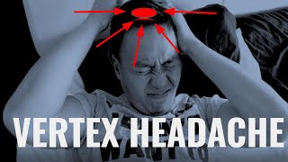 How to relieve top of the head headache  Vertex Headache CHECK THIS MUSCLE [upl. by Norag755]