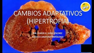 CAMBIOS ADAPTATIVOS  HIPERTROFIA  Dr Elmer Luna Vilchez [upl. by Adrianne]